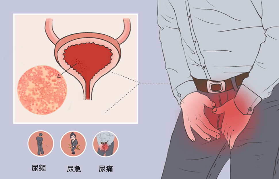 e295ebefb9860ab14ae8dab64d84afe6.png