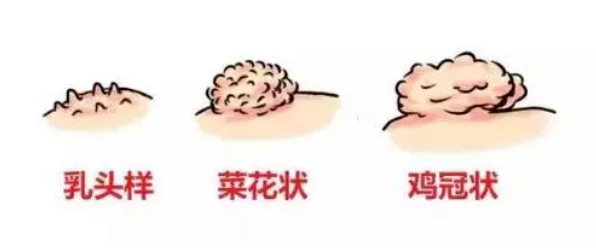 b167f131bd78764815379b3c4fdd444c.png